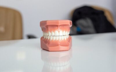 Kāda ir atšķirība starp zobu tiltu un zobu implantiem?