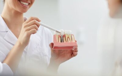 Pilnīga zobu aizstāšana ar zobu implantiem