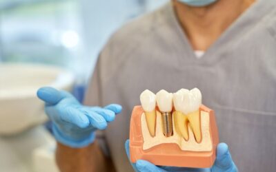 Kādus zobu implantu risinājumus iesaka speciālisti?