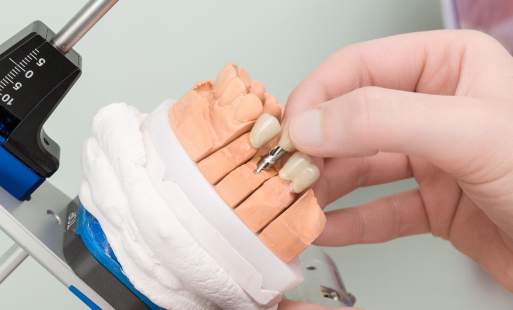 Vai zobu implantu ievietošana ir sāpīga?