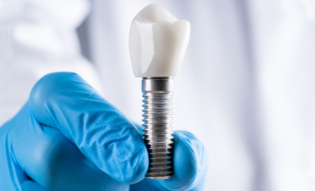 ANKYLOS zobu implantu sistēma
